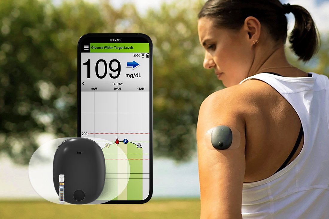 Eversense 365